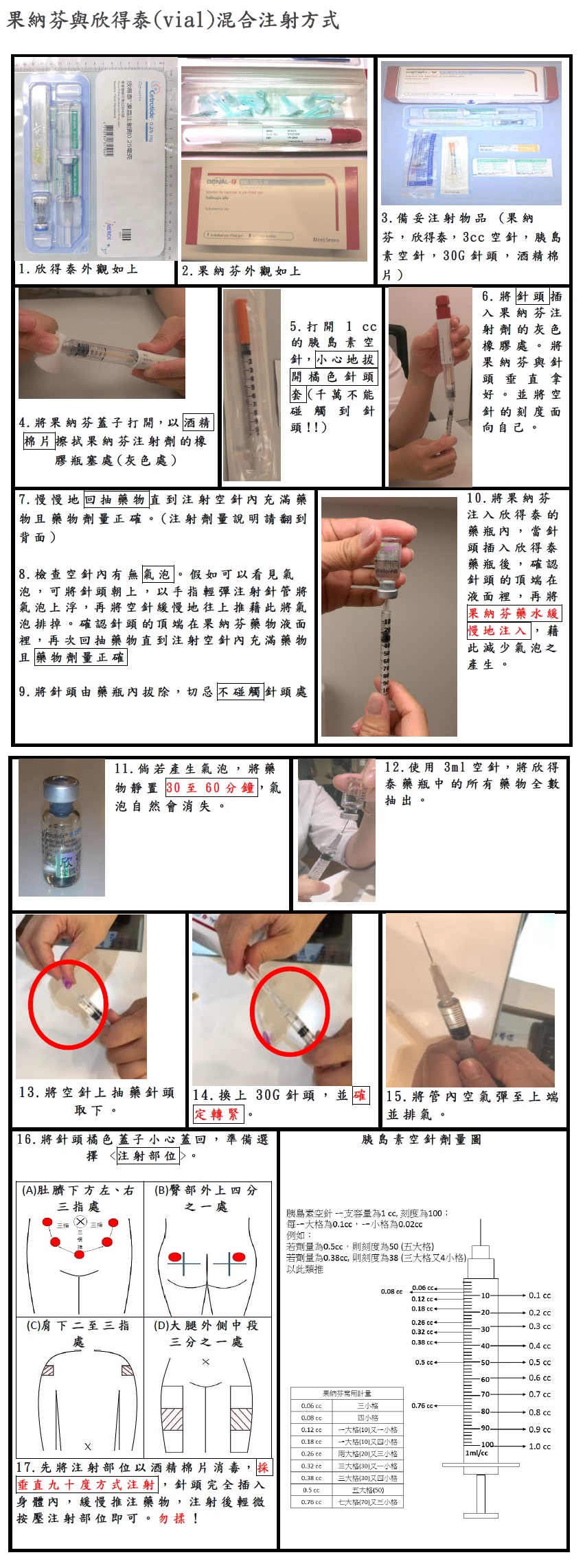 娩俐諾兒(Merional)與果納芬(Gonal-f)使用藥瓶將注射液混為一針的注射方式